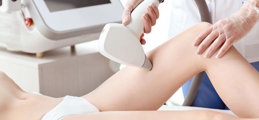 Laser Hair Removal